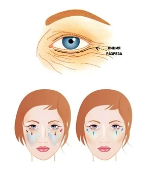 Омоложение лица